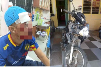 Seorang pengawal keselamatan terpaksa menerima tujuh jahitan selepas motosikal yang ditungganginya terlanggar seekor lembu berkeliaran dalam kejadian di Gong Medang, di sini malam Selasa.