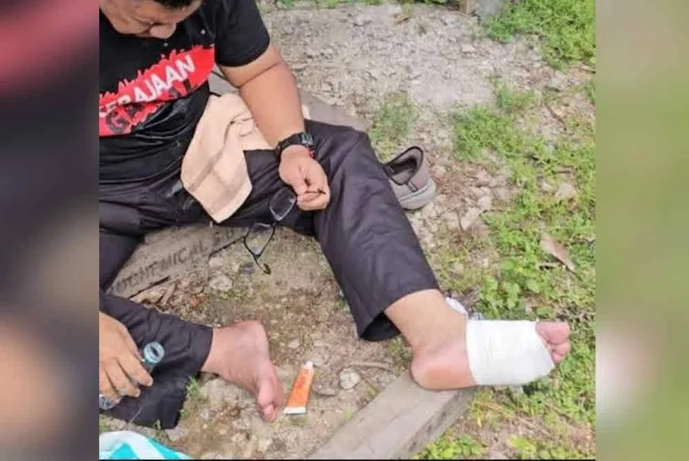 Chegubard terpaksa menghentikan perjalanan hari ketiga dalam misi protes berjalan kaki menuju Mahkamah Johor Bahru kerana kaki melepuh teruk.