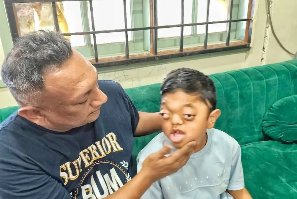 Mohd Fazrul Razduan menunjukkan kecacatan fizikal pada struktur mukaMuhammad Niyaz yang menghidap penyakit Crouzon Syndrome sejak dilahirkan. Foto Sinar Harian.