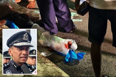 Gambar yang tersebar keadaan salah seorang mangsa yang cedera dipercayai akibat diserang sekumpulan lelaki - Gambar kecil (Alzafny)