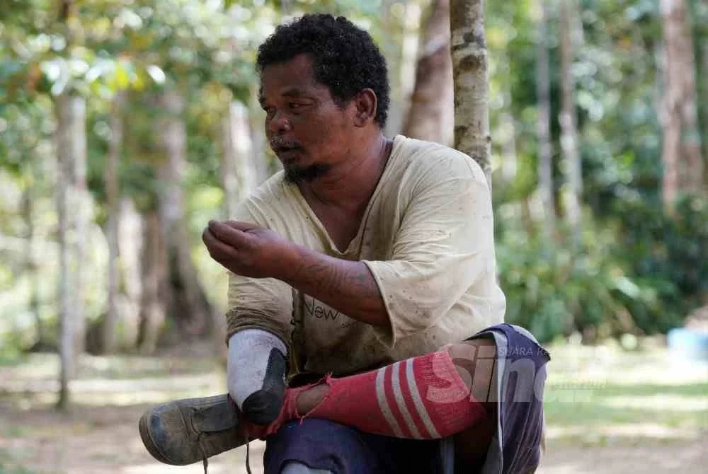 Salah seorang penduduk Kampung Katong yang menceritakan pengalaman pahit terkena mercun buatan tangan ketika hendak menghalau gajah sehinggakan pergelangan tangannya terputus.