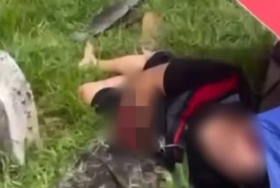 Seorang lelaki putus pergelangan tangan kanan selepas motosikal ditunggang dirempuh sebuah kereta di Jalan Sungai Rambai, Jenjarom pada Selasa. Foto tular