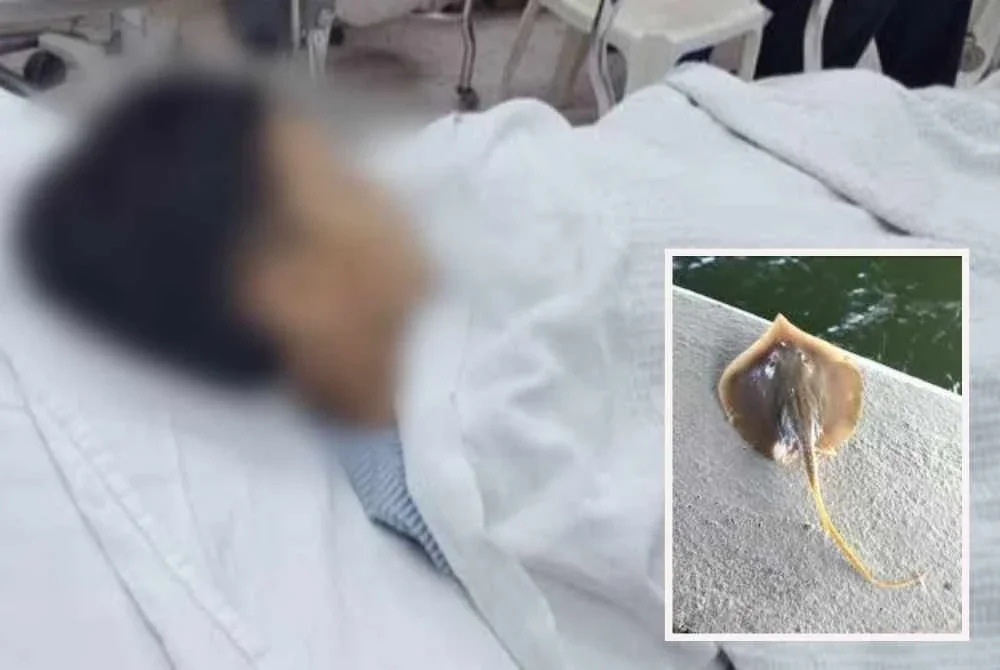 Mangsa dikejarkan ke hospital selepas disengat ikan ketuka iaitu spesies ikan pari kecil ketika mandi di Pantai Tanjung Asam, Gerak Sanggul. Foto ihsan pembaca