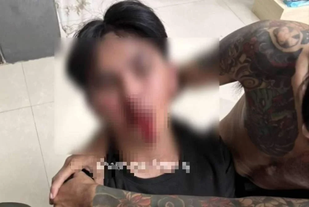 Mangsa yang berusia 21 tahun mengalami kecederaan serius selepas diserang oleh teman lelaki wanita berkenaan.