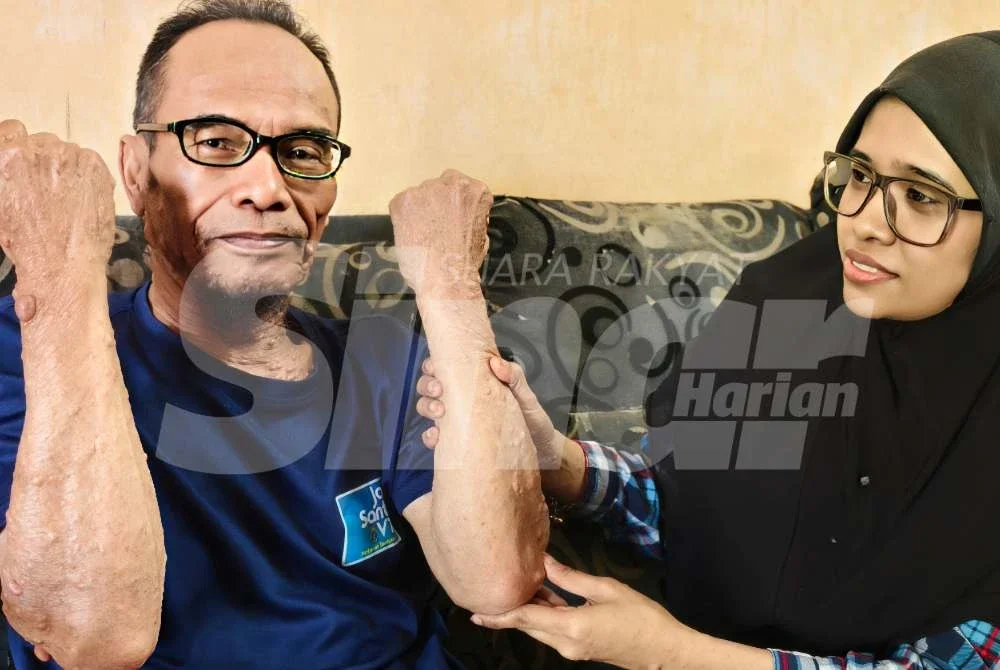 Siti Nur Aishah (kanan) melihat ketulan pada tangan bapanya.