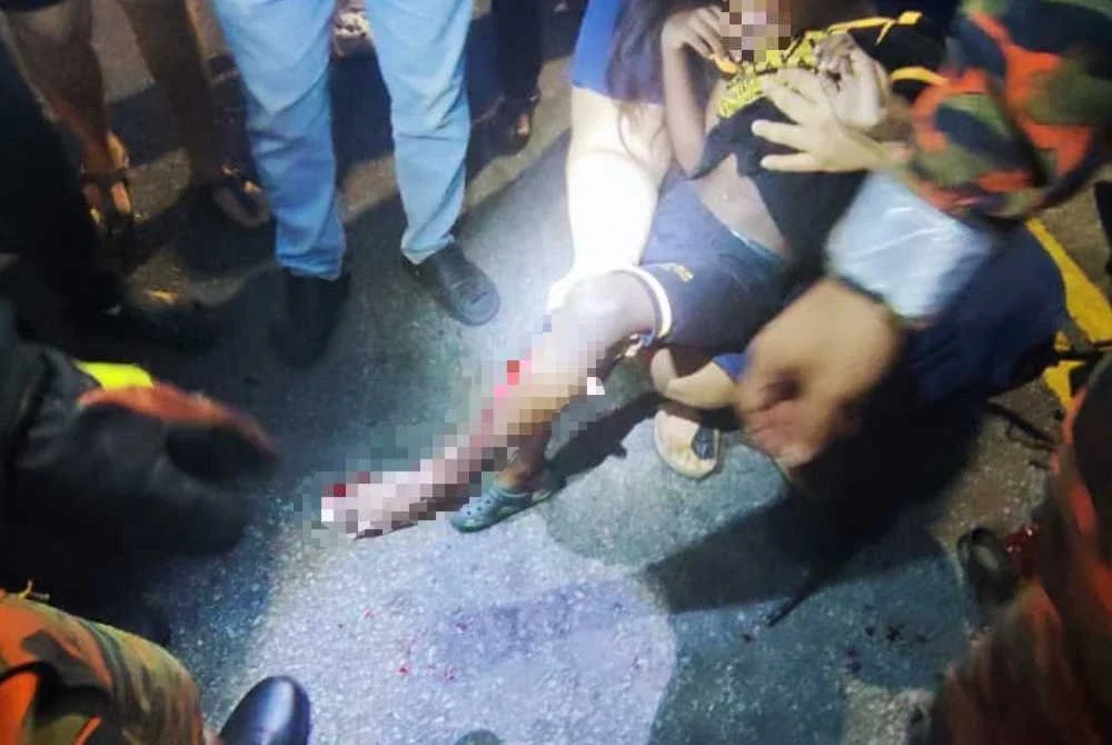 Kaki kanak-kanak tersebut cedera selepas tersangkut dalam 'sprocket' motosikal yang dinaikinya.