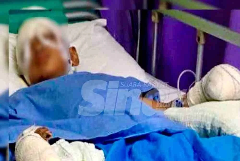 Gambar Eiman Najwan semasa dirawat di Hospital Pakar Universiti Sains Malaysia, Kubang Kerian, Kota Bharu lapan tahun lalu kerana terkena letupan mercun.