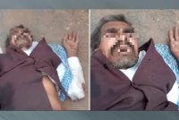 Seorang lelaki berusia 60 tahun parah selepas dipukul dan diseret di belakang motosikal. Foto NDTV