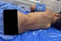 Kanak-kanak terbabit menerima rawatan selepas diselamatkan. Foto: Agensi