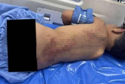 Kanak-kanak terbabit menerima rawatan selepas diselamatkan. Foto: Agensi