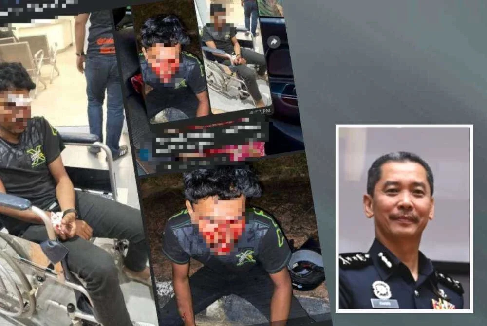 Hantaran tular di media sosial mendakwa seorang lelaki cedera akibat dipukul anggota polis dalam kejadian di Dungun pada Jumaat. - Gambar kecil (Mohd Khairi)