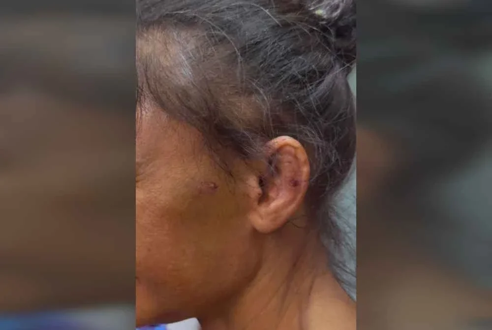 Pembantu rumah warga Indonesia disyaki menjadi mangsa eksploitasi diselamatkan imigresen. Foto JIM Negeri Sembilan