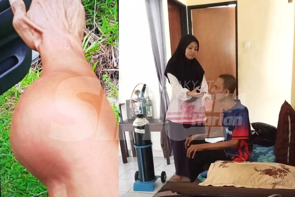 Ketulan pada lengan Mohamed Hafiz akhirnya disahkan sebagai kanser tisu lembut.