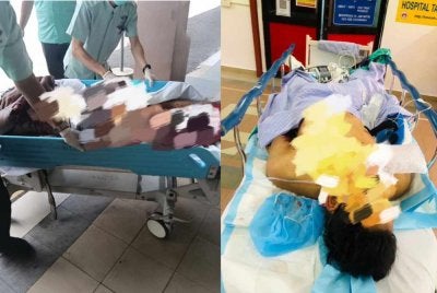 Mekanik putus kaki akibat letupan 'aircond' kereta kini sedang menerima rawatan di ICU, Hospital Tanah Merah.