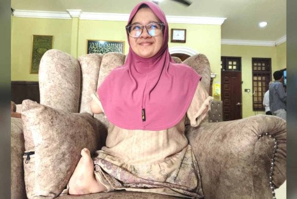 Nur Damia Irsalina menghidap Sindrom Tetra-amelia dan kini mendapatkan rawatan rehabilitasi serta rawatan pakar tulang secara berkala.