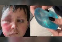 Seorang kanak-kanak lelaki hampir kehilangan penglihatan selepas memanaskan mainan sensori di ketuhar gelombang mikro. Foto Agensi