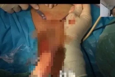 Siaran langsung yang mencetuskan kontroversi di China. Foto tular sosial media