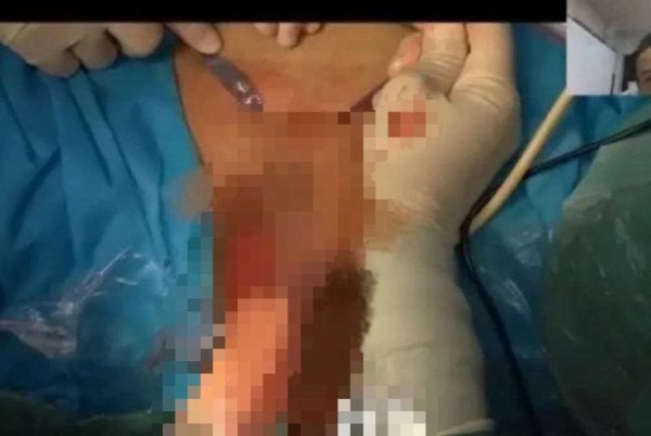 Siaran langsung yang mencetuskan kontroversi di China. Foto tular sosial media