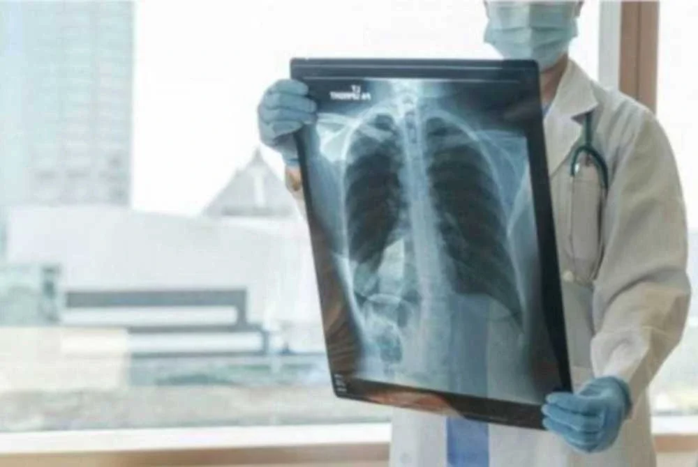 Rawatan tibi menggunakan antibiotik seperti rifampin, ethambutol dan isoniazid perlu diambil selama enam hingga sembilan bulan dan hanya berkesan sekiranya pesakit melengkapkan sesi rawatan. Foto hiasan