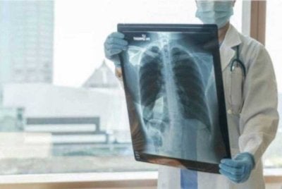 Rawatan tibi menggunakan antibiotik seperti rifampin, ethambutol dan isoniazid perlu diambil selama enam hingga sembilan bulan dan hanya berkesan sekiranya pesakit melengkapkan sesi rawatan. Foto hiasan