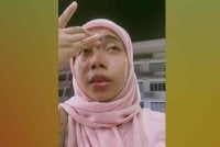 Kamisa mendedahkan matanya menjadi merah dan ia menjadi pengajaran buat dirinya apabila tibi mata hampir meragut penglihatannya.