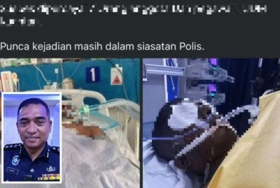 Tular gambar mangsa sedang menjalani rawatan selepas didakwa dibuli dan dipukul menggunakan kayu serta besi dalam sebuah kem di sini. Gambar kecil: Ashari