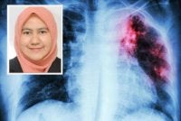Laporan Kementerian Kesihatan Malaysia dalam tempoh beberapa minggu pertama 2026 sahaja, ribuan kes direkodkan di seluruh negara. Gambar kecil: Dr Haliza Abdul Rahman.
