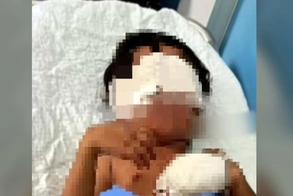 Mangsa dirujuk ke Hospital Sultan Abdul Halim di Sungai Petani untuk rawatan lanjut.