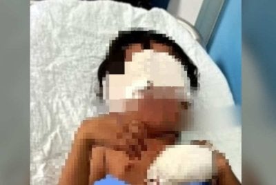 Mangsa dirujuk ke Hospital Sultan Abdul Halim di Sungai Petani untuk rawatan lanjut.