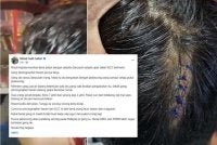 Kecederaan yang dialami dua mangsa selepas didakwa dipukul jurugambar haram di KLCC. Gambar kecil: Tangkap layar Facebook milik pempengaruh yang juga bekas guru, Mohd Fadli Salleh berhubung kejadian dua lelaki didakwa menjadi mangsa pukul jurugambar haram di KLCC.