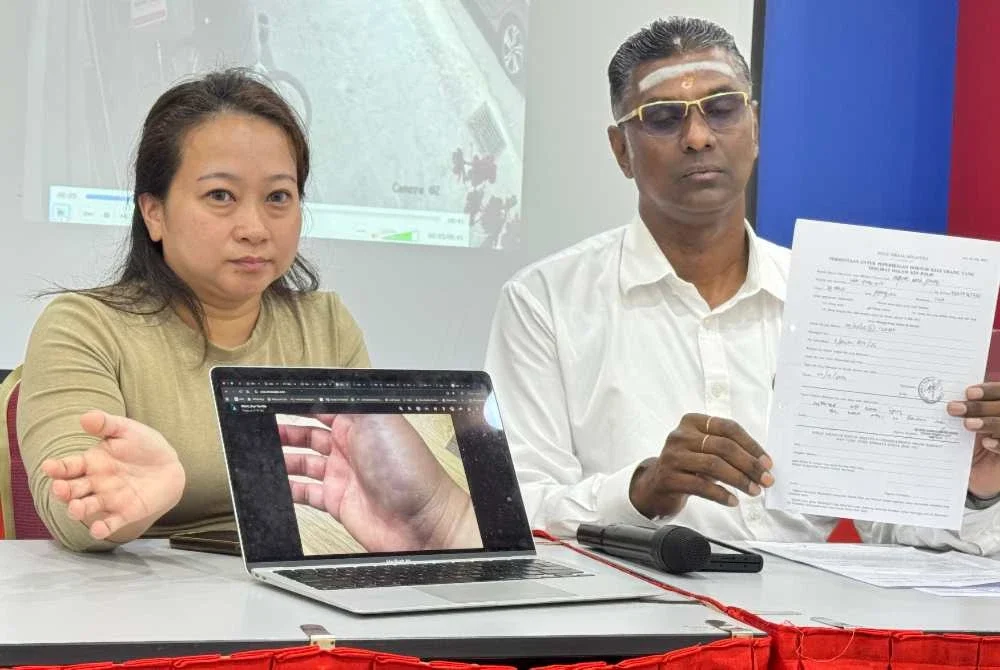 Rayer menunjukkan laporan polis yang dibuat manakala Yean Nie menunjukkan gambar tangannya yang cedera.