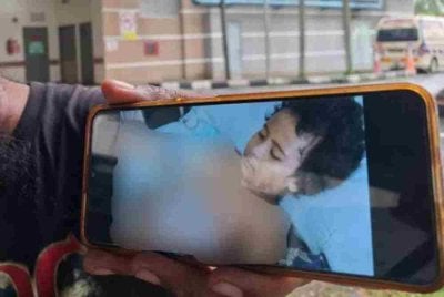 Nur Kaisah Zahra Abdul Ghafar, 9, masih menerima rawatan di Hospital Taiping selepas mengalami kecederaan melecur serius apabila tubuhnya disambar api,