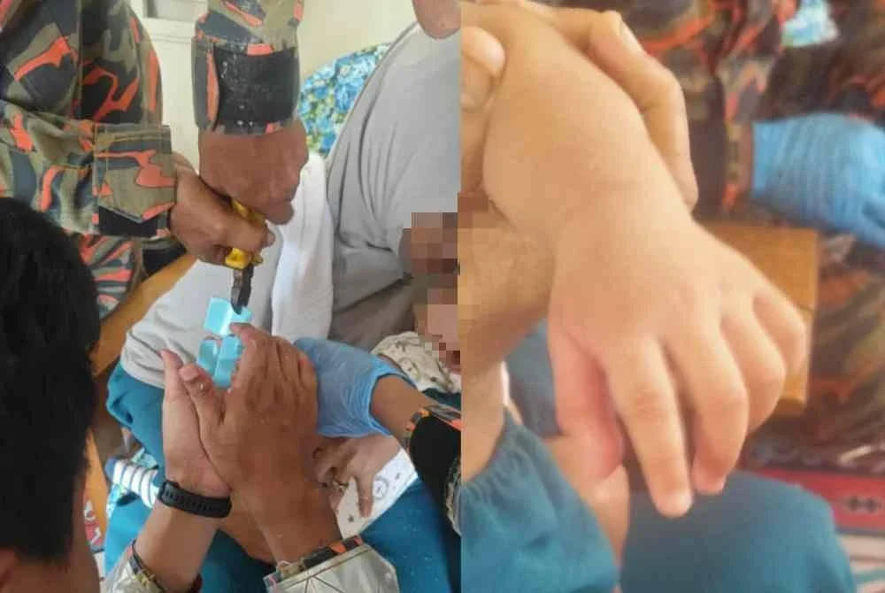 Ibu jari kanan seorang bayi tersepit pada 'baby walker' dalam kejadian pada Selasa.