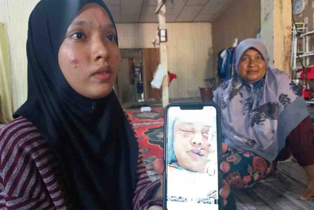 Keluarga menunjukkan gambar Mohamad Amirullah yang kini menerima rawatan di Hospital Sultanah Aminah, Johor Bharu, Johor. 