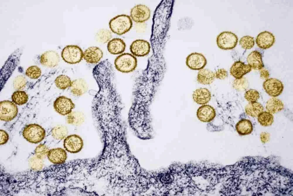 Imej mikrograf elektron menunjukkan virus Sin Nombre Hantavirus. Foto: Agensi