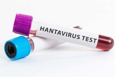 Indonesia melaporkan dua kes disyaki hantavirus di Jakarta dan Yogyakarta. Foto hiasan