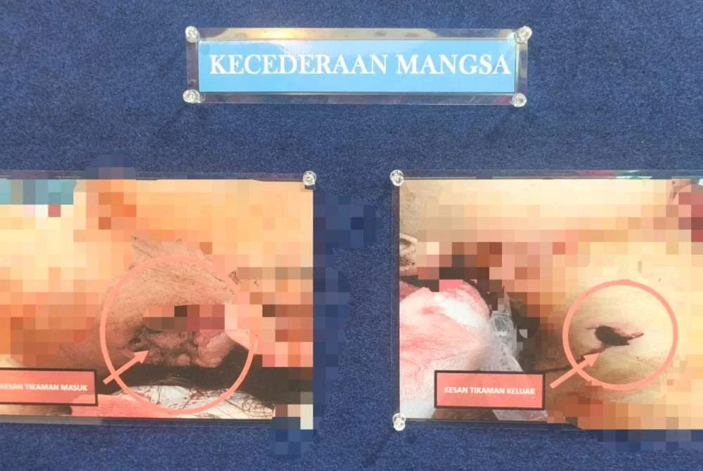 Kesan kecederaan yang dialami oleh mangsa.