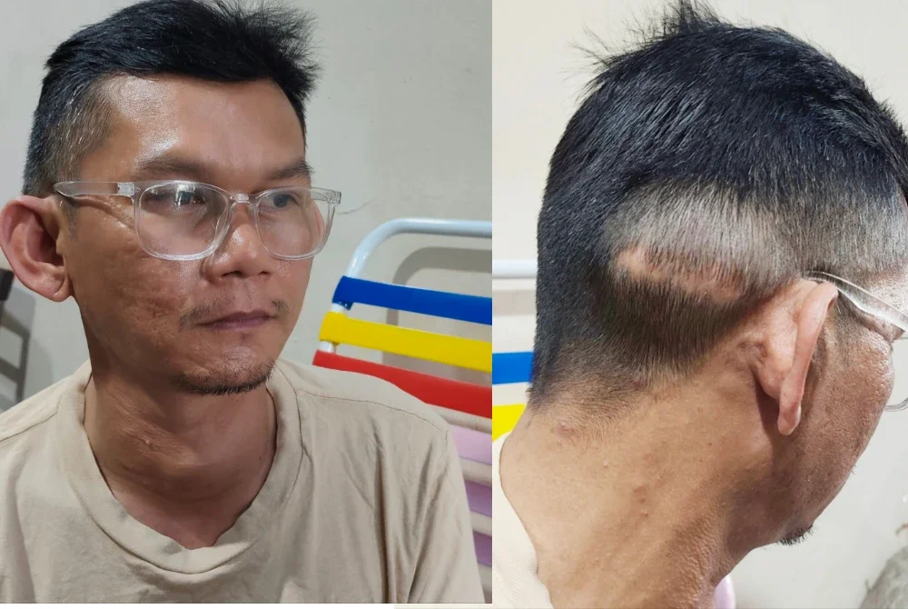 Tiroid pada leher Mohd Riduwan semakin membesar dan memerlukan pembedahan