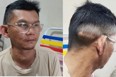 Tiroid pada leher Mohd Riduwan semakin membesar dan memerlukan pembedahan