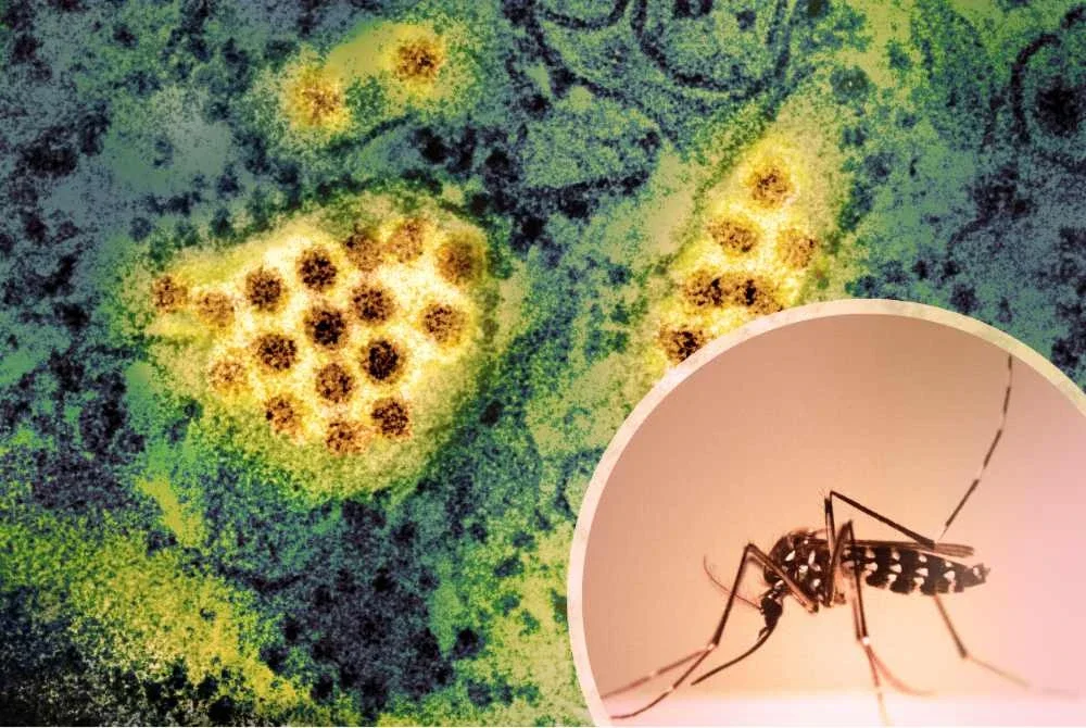 No Image Caption