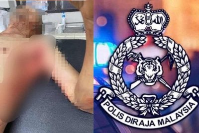 Seorang warga emas cedera pada bahagian ketiak kiri selepas ditanduk lembu dalam kejadian di Kampung Murni, Layang-layang, Kluang.- Foto tular