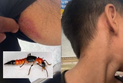 Antara kesan gigitan semut charlie yang dikesan menyerang perumahan itu sejak dua minggu lalu.Gambar kecil: semut charlie.