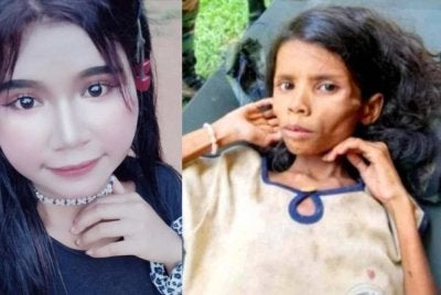 Foto terkini Miksudiar (kiri) manakala foto Miksudiar (kanan) ditemukan dalam keadaan mengalami kekurangan zat makanan yang serius selepas sesat selama 47 hari di hutan Bertam berhampiran Pos Tohoi, Gua Musang pada 2015. 