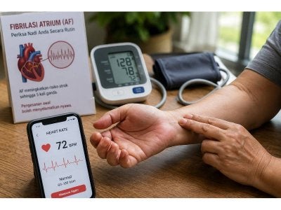 Di peringkat global, Kajian Framingham mendapati AF menyumbang kepada 20 hingga 30 peratus daripada keseluruhan strok iskemia atau angin ahmar.