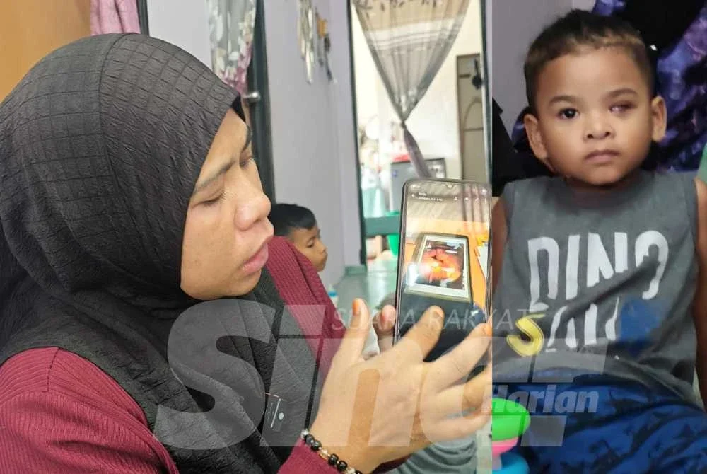 Nurul Darvina menunjukkan mata Dayyan yang sudah dibedah pada Mei lalu.