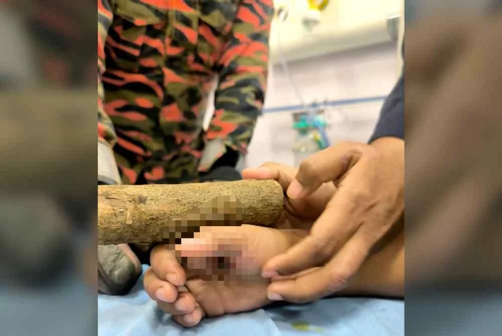 Doktor yang merawat mangsa meminta bantuan bomba kerana kayu berkenaan terlalu panjang dan menyukarkan proses rawatan. Foto JBPM