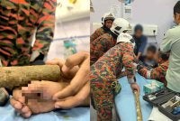 Operasi memotong kayu mengambil masa kira-kira 10 hingga 15 minit sebelum mangsa diserahkan semula kepada pihak hospital untuk rawatan lanjut. Foto JBPM