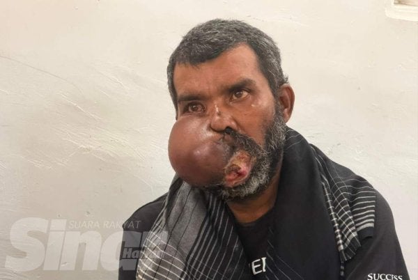 Rosli yang menderita penyakit kanser mulut kini sudah tidak boleh makan seperti biasa dan hanya bergantung kepada air yang diminum.