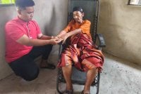 Muhammad Irfan menunjukkan keadaan tangan dan kaki Nor Sadri yang membengkak disebabkan oleh masalah kesihatan dihidapinya.