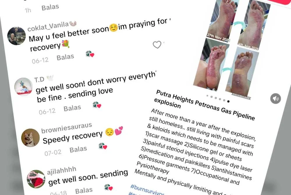 Tangkap layar akaun Tik Tok mangsa dan komen pengguna Tik Tok yang rata-ratanya bersimpati terhadap derita ditanggung mangsa terbabit.